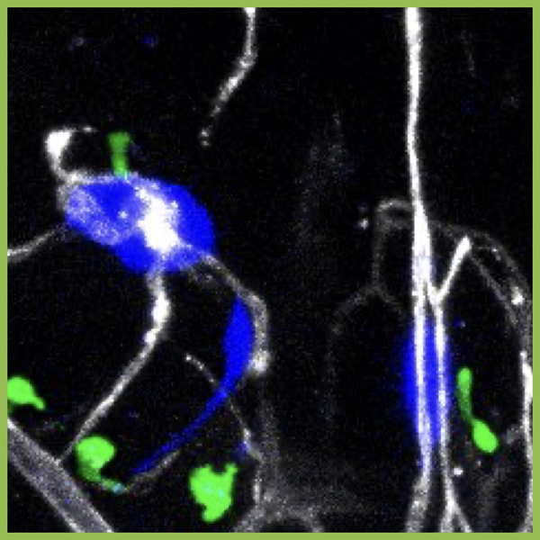 Dr. Kandice Tanner: <i> Human breast cancer cells (blue) hijacking blood vessels (gray) in the presence of the immune cells (green) visualized in the zebrafish brain</i>
